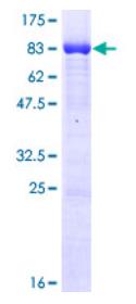 SDS-PAGE (CLK1-1491H).jpg
